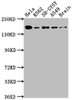 Western Blot<br />
 Positive WB detected in: Hela whole cell lysate, K562 whole cell lysate, SH-SY5Y whole cell lysate, A549 whole cell lysate, Rat Brain whole cell lysate<br />
 All lanes: APC antibody at 1:1000<br />
 Secondary<br />
 Goat polyclonal to rabbit IgG at 1/50000 dilution<br />
 Predicted band size: 312, 301, 309 kDa<br />
 Observed band size: 160 kDa<br />