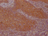 IHC image of CSB-RA267691A0HU diluted at 1:100 and staining in paraffin-embedded human tonsil tissue performed on a Leica BondTM system. After dewaxing and hydration, antigen retrieval was mediated by high pressure in a citrate buffer (pH 6.0). Section was blocked with 10% normal goat serum 30min at RT. Then primary antibody (1% BSA) was incubated at 4°C overnight. The primary is detected by a Goat anti-rabbit IgG polymer labeled by HRP and visualized using 0.05% DAB.