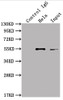 Immunoprecipitating ILK in Hela whole cell lysate<br />
 Lane 1: Rabbit control IgG instead of CSB-RA963626A0HU in Hela whole cell lysate.
 For western blotting,a HRP-conjugated Protein G antibody was used as the secondary antibody (1/2000)<br />
 Lane 2: CSB-RA963626A0HU（2µg）+ Hela whole cell lysate（500µg）<br />
 Lane 3: Hela whole cell lysate (10µg)<br />