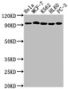 Western Blot<br />
 Positive WB detected in: Hela whole cell lysate, MCF-7 whole cell lysate, K562 whole cell lysate, HL60 whole cell lysate, PC-3 whole cell lysate<br />
 All lanes: TOP1 antibody at 1:2000<br />
 Secondary<br />
 Goat polyclonal to rabbit IgG at 1/50000 dilution<br />
 Predicted band size: 91 kDa<br />
 Observed band size: 91 kDa<br />