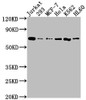 Western Blot<br />
 Positive WB detected in: Jurkat whole cell lysate, 293 whole cell lysate, MCF-7 whole cell lysate, Hela whole cell lysate, K562 whole cell lysate, HL60 whole cell lysate<br />
 All lanes: PTPN11 antibody at 1:2000<br />
 Secondary<br />
 Goat polyclonal to rabbit IgG at 1/50000 dilution<br />
 Predicted band size: 69, 53 kDa<br />
 Observed band size: 69 kDa<br />