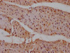 IHC image of CSB-RA289762A0HU diluted at 1:100 and staining in paraffin-embedded human heart tissue performed on a Leica BondTM system. After dewaxing and hydration, antigen retrieval was mediated by high pressure in a citrate buffer (pH 6.0). Section was blocked with 10% normal goat serum 30min at RT. Then primary antibody (1% BSA) was incubated at 4°C overnight. The primary is detected by a Goat anti-rabbit IgG polymer labeled by HRP and visualized using 0.05% DAB.