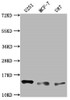 Western Blot<br />
 Positive WB detected in: U251 whole cell lysate, MCF-7 whole cell lysate, U87 whole cell lysate<br />
 All lanes: TNFRSF12A antibody at 1:2000<br />
 Secondary<br />
 Goat polyclonal to rabbit IgG at 1/50000 dilution<br />
 Predicted band size: 14, 11 kD<br />
 Observed band size: 14 kDa<br />