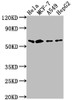 Western Blot<br />
 Positive WB detected in: Hela whole cell lysate, MCF-7 whole cell lysate, A549 whole cell lysate, HepG2 whole cell lysate<br />
 All lanes: SOX10 antibody at 1:2000<br />
 Secondary<br />
 Goat polyclonal to rabbit IgG at 1/50000 dilution<br />
 Predicted band size: 50, 32 kDa<br />
 Observed band size: 60 kDa<br />