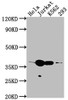 Western Blot<br />
 Positive WB detected in: Hela whole cell lysate, Jurkat whole cell lysate, K562 whole cell lysate, 293 whole cell lysate<br />
 All lanes: CDK6 antibody at 1:2000<br />
 Secondary<br />
 Goat polyclonal to rabbit IgG at 1/50000 dilution<br />
 Predicted band size: 37 kDa<br />
 Observed band size: 37 kDa<br />