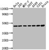Western Blot<br />
 Positive WB detected in: Hela whole cell lysate, 293 whole cell lysate, MCF-7 whole cell lysate, 293T whole cell lysate, A549 whole cell lysate, U251 whole cell lysate, Rat brain tissue<br />
 All lanes: MAP2K1 antibody at 1:2000<br />
 Secondary<br />
 Goat polyclonal to rabbit IgG at 1/50000 dilution<br />
 Predicted band size: 44, 41 kDa<br />
 Observed band size: 44 kDa<br />
