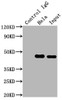 Immunoprecipitating MAP2K1 in Hela whole cell lysate<br />
 Lane 1: Rabbit control IgG instead of CSB-RA957619A0HU in Hela whole cell lysate.
 For western blotting,a HRP-conjugated Protein G antibody was used as the secondary antibody (1/2000)<br />
 Lane 2: CSB-RA957619A0HU（2µg）+ Hela whole cell lysate（500µg）<br />
 Lane 3: Hela whole cell lysate (10µg)<br />