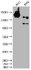 Western Blot<br />
 Positive WB detected in: Raji whole cell lysate, K562 whole cell lysate<br />
 All lanes: INPP5D antibody at 1:1500<br />
 Secondary<br />
 Goat polyclonal to rabbit IgG at 1/50000 dilution<br />
 Predicted band size: 134, 110 kDa<br />
 Observed band size: 145 kDa<br />