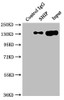 Immunoprecipitating SHIP in Raji whole cell lysate<br />
 Lane 1: Rabbit control IgG instead of CSB-RA157463A0HU in Raji whole cell lysate.
 For western blotting,a HRP-conjugated Protein G antibody was used as the secondary antibody (1/2000)<br />
 Lane 2: CSB-RA157463A0HU（2µg）+ Raji whole cell lysate（500µg）<br />
 Lane 3: Raji whole cell lysate (10µg)<br />