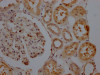 IHC image of CSB-RA156557A0HU diluted at 1:100 and staining in paraffin-embedded human kidney tissue performed on a Leica BondTM system. After dewaxing and hydration, antigen retrieval was mediated by high pressure in a citrate buffer (pH 6.0). Section was blocked with 10% normal goat serum 30min at RT. Then primary antibody (1% BSA) was incubated at 4°C overnight. The primary is detected by a Goat anti-rabbit IgG polymer labeled by HRP and visualized using 0.05% DAB.