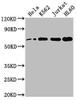 Western Blot<br />
 Positive WB detected in: Hela whole cell lysate, K562 whole cell lysate, Jurkat whole cell lysate, HL60 whole cell lysate<br />
 All lanes: HDAC1 antibody at 1:2000<br />
 Secondary<br />
 Goat polyclonal to rabbit IgG at 1/50000 dilution<br />
 Predicted band size: 56 kDa<br />
 Observed band size: 60 kDa<br />