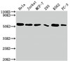 Western Blot<br />
 Positive WB detected in: Hela whole cell lysate, Jurkat whole cell lysate, MCF-7 whole cell lysate, 293 whole cell lysate, K562 whole cell lysate, PC-3 whole cell lysate<br />
 All lanes: CDC37 antibody at 1:2000<br />
 Secondary<br />
 Goat polyclonal to rabbit IgG at 1/50000 dilution<br />
 Predicted band size: 45 kDa<br />
 Observed band size: 50 kDa<br />