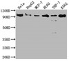 Western Blot<br />
 Positive WB detected in: Hela whole cell lysate, HepG2 whole cell lysate, MCF-7 whole cell lysate, HL60 whole cell lysate, THP-1 whole cell lysate, K562 whole cell lysate<br />
 All lanes: SUZ12 antibody at 1:2000<br />
 Secondary<br />
 Goat polyclonal to rabbit IgG at 1/50000 dilution<br />
 Predicted band size: 84 kDa<br />
 Observed band size: 90 kDa<br />