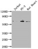Western Blot<br />
 Positive WB detected in: Jurkat whole cell lysate, PC-3 whole cell lysate, Rat Heart tissue<br />
 All lanes: E2F1 antibody at 1:2000<br />
 Secondary<br />
 Goat polyclonal to rabbit IgG at 1/50000 dilution<br />
 Predicted band size: 47 kDa<br />
 Observed band size: 60 kDa<br />