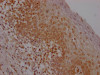 IHC image of CSB-RA826096A0HU diluted at 1:100 and staining in paraffin-embedded human tonsil tissue performed on a Leica BondTM system. After dewaxing and hydration, antigen retrieval was mediated by high pressure in a citrate buffer (pH 6.0). Section was blocked with 10% normal goat serum 30min at RT. Then primary antibody (1% BSA) was incubated at 4°C overnight. The primary is detected by a Goat anti-rabbit IgG polymer labeled by HRP and visualized using 0.05% DAB.