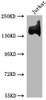 Western Blot<br />
 Positive WB detected in: Jurkat whole cell lysate<br />
 All lanes: ITGA4 antibody at 1:1500<br />
 Secondary<br />
 Goat polyclonal to rabbit IgG at 1/50000 dilution<br />
 Predicted band size: 115, 26 kDa<br />
 Observed band size: 140 kDa<br />