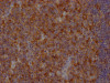 IHC image of CSB-RA252392A0HU diluted at 1:100 and staining in paraffin-embedded human tonsil tissue performed on a Leica BondTM system. After dewaxing and hydration, antigen retrieval was mediated by high pressure in a citrate buffer (pH 6.0). Section was blocked with 10% normal goat serum 30min at RT. Then primary antibody (1% BSA) was incubated at 4°C overnight. The primary is detected by a Goat anti-rabbit IgG polymer labeled by HRP and visualized using 0.05% DAB.