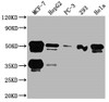 Western Blot<br />
 Positive WB detected in: MCF-7 whole cell lysate, HepG2 whole cell lysate, PC-3 whole cell lysate, 293 whole cell lysate, Hela whole cell lysate<br />
 All lanes: FOXA1 antibody at 1:2000<br />
 Secondary<br />
 Goat polyclonal to rabbit IgG at 1/50000 dilution<br />
 Predicted band size: 50, 46 kDa<br />
 Observed band size: 50 kDa<br />