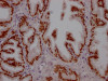 IHC image of CSB-RA246102A0HU diluted at 1:100 and staining in paraffin-embedded human prostate tissue performed on a Leica BondTM system. After dewaxing and hydration, antigen retrieval was mediated by high pressure in a citrate buffer (pH 6.0). Section was blocked with 10% normal goat serum 30min at RT. Then primary antibody (1% BSA) was incubated at 4°C overnight. The primary is detected by a Goat anti-rabbit IgG polymer labeled by HRP and visualized using 0.05% DAB.
