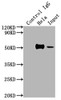 Immunoprecipitating FOXA1 in Hela whole cell lysate<br />
 Lane 1: Rabbit control IgG instead of CSB-RA246102A0HU in Hela whole cell lysate.
 For western blotting,a HRP-conjugated Protein G antibody was used as the secondary antibody (1/2000)<br />
 Lane 2: CSB-RA246102A0HU（2µg）+ Hela whole cell lysate（500µg）<br />
 Lane 3: Hela whole cell lysate (10µg)<br />