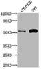 Western Blot<br />
 Positive WB detected in: COLO320 whole cell lysate, 293 whole cell lysate<br />
 All lanes: TP53 antibody at 1:2000<br />
 Secondary<br />
 Goat polyclonal to rabbit IgG at 1/50000 dilution<br />
 Predicted band size: 44, 38, 39, 40, 34, 35, 30, 24, 25 kDa<br />
 Observed band size: 53 kDa<br />