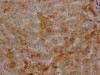 IHC image of CSB-RA437590A0HU diluted at 1:100 and staining in paraffin-embedded human liver tissue performed on a Leica BondTM system. After dewaxing and hydration, antigen retrieval was mediated by high pressure in a citrate buffer (pH 6.0). Section was blocked with 10% normal goat serum 30min at RT. Then primary antibody (1% BSA) was incubated at 4°C overnight. The primary is detected by a Goat anti-rabbit IgG polymer labeled by HRP and visualized using 0.05% DAB.