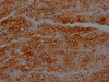 IHC image of CSB-RA271553A0HU diluted at 1:100 and staining in paraffin-embedded human heart tissue performed on a Leica BondTM system. After dewaxing and hydration, antigen retrieval was mediated by high pressure in a citrate buffer (pH 6.0). Section was blocked with 10% normal goat serum 30min at RT. Then primary antibody (1% BSA) was incubated at 4°C overnight. The primary is detected by a Goat anti-rabbit IgG polymer labeled by HRP and visualized using 0.05% DAB.