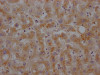 IHC image of CSB-RA224179A0HU diluted at 1:100 and staining in paraffin-embedded human liver tissue performed on a Leica BondTM system. After dewaxing and hydration, antigen retrieval was mediated by high pressure in a citrate buffer (pH 6.0). Section was blocked with 10% normal goat serum 30min at RT. Then primary antibody (1% BSA) was incubated at 4°C overnight. The primary is detected by a Goat anti-rabbit IgG polymer labeled by HRP and visualized using 0.05% DAB.