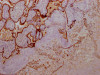 IHC image of CSB-RA891358A0HU diluted at 1:100 and staining in paraffin-embedded human placenta tissue performed on a Leica BondTM system. After dewaxing and hydration, antigen retrieval was mediated by high pressure in a citrate buffer (pH 6.0). Section was blocked with 10% normal goat serum 30min at RT. Then primary antibody (1% BSA) was incubated at 4°C overnight. The primary is detected by a Goat anti-rabbit IgG polymer labeled by HRP and visualized using 0.05% DAB.