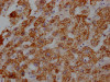 IHC image of CSB-RA216446A0HU diluted at 1:100 and staining in paraffin-embedded human liver tissue performed on a Leica BondTM system. After dewaxing and hydration, antigen retrieval was mediated by high pressure in a citrate buffer (pH 6.0). Section was blocked with 10% normal goat serum 30min at RT. Then primary antibody (1% BSA) was incubated at 4°C overnight. The primary is detected by a Goat anti-rabbit IgG polymer labeled by HRP and visualized using 0.05% DAB.