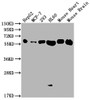 Western Blot<br />
 Positive WB detected in: HepG2 whole cell lysate, MCF-7 whole cell lysate, 293 whole cell lysate, HL60 whole cell lysate, Mouse Heart tissue, Mouse Brain tissue<br />
 All lanes: ATP5F1A antibody at 1:2000<br />
 Secondary<br />
 Goat polyclonal to rabbit IgG at 1/50000 dilution<br />
 Predicted band size: 60, 55, 58 kDa<br />
 Observed band size: 60 kDa<br /> Western Blot<br />
 Positive WB detected in: HepG2 whole cell lysate, MCF-7 whole cell lysate, 293 whole cell lysate, HL60 whole cell lysate, Mouse Heart tissue, Mouse Brain tissue<br />
 All lanes: ATP5F1A antibody at 1:2000<br />
 Secondary<br />
 Goat polyclonal to rabbit IgG at 1/50000 dilution<br />
 Predicted band size: 60, 55, 58 kDa<br />
 Observed band size: 60 kDa<br />