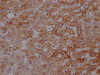 IHC image of CSB-RA159926A0HU diluted at 1:100 and staining in paraffin-embedded human liver tissue performed on a Leica BondTM system. After dewaxing and hydration, antigen retrieval was mediated by high pressure in a citrate buffer (pH 6.0). Section was blocked with 10% normal goat serum 30min at RT. Then primary antibody (1% BSA) was incubated at 4°C overnight. The primary is detected by a Goat anti-rabbit IgG polymer labeled by HRP and visualized using 0.05% DAB.