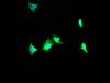 Immunofluorescence staining of SY5Y Cells with CSB-RA182227A0HU at 1：50, counter-stained with DAPI. The cells were fixed in 4% formaldehyde, permeated by 0.2% TritonX-100, and blocked in 10% normal Goat Serum. The cells were then incubated with the antibody overnight at 4°C. Nuclear DNA was labeled in blue with DAPI. The secondary antibody was FITC-conjugated AffiniPure Goat Anti-Rabbit IgG （H+L）.