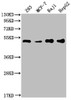 Western Blot<br />
 Positive WB detected in: 293 whole cell lysate, MCF-7 whole cell lysate, Raji whole cell lysate, HepG2 whole cell lysate<br />
 All lanes: PABPN1 antibody at 1:2000<br />
 Secondary<br />
 Goat polyclonal to rabbit IgG at 1/50000 dilution<br />
 Predicted band size: 33, 32, 38 kDa<br />
 Observed band size: 50 kDa<br />