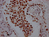 IHC image of CSB-RA569290A0HU diluted at 1:100 and staining in paraffin-embedded human testis tissue performed on a Leica BondTM system. After dewaxing and hydration, antigen retrieval was mediated by high pressure in a citrate buffer (pH 6.0). Section was blocked with 10% normal goat serum 30min at RT. Then primary antibody (1% BSA) was incubated at 4°C overnight. The primary is detected by a Goat anti-rabbit IgG polymer labeled by HRP and visualized using 0.05% DAB.