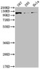 Western Blot<br />
 Positive WB detected in: U87 whole cell lysate, 293 whole cell lysate, Hela whole cell lysate<br />
 All lanes: FGFR3 antibody at 1:2000<br />
 Secondary<br />
 Goat polyclonal to rabbit IgG at 1/50000 dilution<br />
 Predicted band size: 88, 89, 76, 86 kDa<br />
 Observed band size: 115 kDa<br />