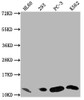 Western Blot<br />
 Positive WB detected in: HL60 whole cell lysate, 293 whole cell lysate, PC-3 whole cell lysate, K562 whole cell lysate<br />
 All lanes: MIF antibody at 1:1500<br />
 Secondary<br />
 Goat polyclonal to rabbit IgG at 1/50000 dilution<br />
 Predicted band size: 13 kDa<br />
 Observed band size: 13 kDa<br />