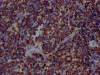 IHC image of CSB-RA160472A0HU diluted at 1:100 and staining in paraffin-embedded human lung cancer performed on a Leica BondTM system. After dewaxing and hydration, antigen retrieval was mediated by high pressure in a citrate buffer (pH 6.0). Section was blocked with 10% normal goat serum 30min at RT. Then primary antibody (1% BSA) was incubated at 4°C overnight. The primary is detected by a Goat anti-rabbit IgG polymer labeled by HRP and visualized using 0.05% DAB.