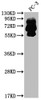 Western Blot<br />
 Positive WB detected in: PC-3 whole cell lysate<br />
 All lanes: PCSK9 antibody at 1:2000<br />
 Secondary<br />
 Goat polyclonal to rabbit IgG at 1/50000 dilution<br />
 Predicted band size: 75, 21 kDa<br />
 Observed band size: 60, 75 kDa<br /> Western Blot<br />
 Positive WB detected in: PC-3 whole cell lysate<br />
 All lanes: PCSK9 antibody at 1:2000<br />
 Secondary<br />
 Goat polyclonal to rabbit IgG at 1/50000 dilution<br />
 Predicted band size: 75, 21 kDa<br />
 Observed band size: 60, 75 kDa<br />