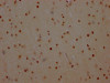 IHC image of CSB-RA581794A0HU diluted at 1:100 and staining in paraffin-embedded human brain tissue performed on a Leica BondTM system. After dewaxing and hydration, antigen retrieval was mediated by high pressure in a citrate buffer (pH 6.0). Section was blocked with 10% normal goat serum 30min at RT. Then primary antibody (1% BSA) was incubated at 4°C overnight. The primary is detected by a Goat anti-rabbit IgG polymer labeled by HRP and visualized using 0.05% DAB.