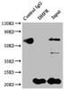 Immunoprecipitating DHFR in Hela whole cell lysate<br />
 Lane 1: Rabbit control IgG instead of CSB-RA264582A0HU in Hela whole cell lysate.
 For western blotting,a HRP-conjugated Protein G antibody was used as the secondary antibody (1/2000)<br />
 Lane 2: CSB-RA264582A0HU（2µg）+ Hela whole cell lysate（500µg）<br />
 Lane 3: Hela whole cell lysate (10µg)<br />