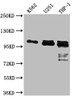 Western Blot<br />
 Positive WB detected in: K562 whole cell lysate, U-251 whole cell lysate, THP-1 whole cell lysate<br />
 All lanes: ITCH antibody at 1:1000<br />
 Secondary<br />
 Goat polyclonal to rabbit IgG at 1/50000 dilution<br />
 Predicted band size: 103, 99, 87 kDa<br />
 Observed band size: 103 kDa<br />