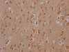 IHC image of CSB-RA616248A0HU diluted at 1:100 and staining in paraffin-embedded human brain tissue performed on a Leica BondTM system. After dewaxing and hydration, antigen retrieval was mediated by high pressure in a citrate buffer (pH 6.0). Section was blocked with 10% normal goat serum 30min at RT. Then primary antibody (1% BSA) was incubated at 4°C overnight. The primary is detected by a Goat anti-rabbit IgG polymer labeled by HRP and visualized using 0.05% DAB.