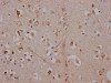 IHC image of CSB-RA224168A0HU diluted at 1:100 and staining in paraffin-embedded human brain tissue performed on a Leica BondTM system. After dewaxing and hydration, antigen retrieval was mediated by high pressure in a citrate buffer (pH 6.0). Section was blocked with 10% normal goat serum 30min at RT. Then primary antibody (1% BSA) was incubated at 4°C overnight. The primary is detected by a Goat anti-rabbit IgG polymer labeled by HRP and visualized using 0.05% DAB.