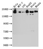 Western Blot<br />
 Positive WB detected in: Hela whole cell lysate, MCF-7 whole cell lysate, L02 whole cell lysate, HepG2 whole cell lysate, Mouse Brain whole cell lysate, Rat Brain whole cell lysate<br />
 All lanes: ROCK2 antibody at 1:1000<br />
 Secondary<br />
 Goat polyclonal to rabbit IgG at 1/50000 dilution<br />
 Predicted band size: 161 kDa<br />
 Observed band size: 161 kDa<br />