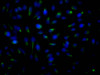 Immunofluorescence staining of Hela Cells with CSB-RA152329A0HU at 1：50, counter-stained with DAPI. The cells were fixed in 4% formaldehyde, permeated by 0.2% TritonX-100, and blocked in 10% normal Goat Serum. The cells were then incubated with the antibody overnight at 4°C. Nuclear DNA was labeled in blue with DAPI. The secondary antibody was FITC-conjugated AffiniPure Goat Anti-Rabbit IgG （H+L）.