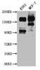 Western Blot<br />
 Positive WB detected in: K562 whole cell lysate, MCF-7 whole cell lysate<br />
 All lanes: mSin3A antibody at 1:1000<br />
 Secondary<br />
 Goat polyclonal to rabbit IgG at 1/50000 dilution<br />
 Predicted band size: 146 kDa<br />
 Observed band size: 146 kDa<br />