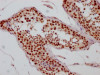 IHC image of CSB-RA242724A0HU diluted at 1:100 and staining in paraffin-embedded human testis tissue performed on a Leica BondTM system. After dewaxing and hydration, antigen retrieval was mediated by high pressure in a citrate buffer (pH 6.0). Section was blocked with 10% normal goat serum 30min at RT. Then primary antibody (1% BSA) was incubated at 4°C overnight. The primary is detected by a Goat anti-rabbit IgG polymer labeled by HRP and visualized using 0.05% DAB.