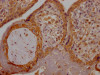 IHC image of CSB-RA280380A0HU diluted at 1:100 and staining in paraffin-embedded human placenta tissue performed on a Leica BondTM system. After dewaxing and hydration, antigen retrieval was mediated by high pressure in a citrate buffer (pH 6.0). Section was blocked with 10% normal goat serum 30min at RT. Then primary antibody (1% BSA) was incubated at 4°C overnight. The primary is detected by a Goat anti-rabbit IgG polymer labeled by HRP and visualized using 0.05% DAB.