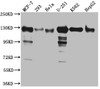 Western Blot<br />
 Positive WB detected in: MCF-7 whole cell lysate, 293 whole cell lysate, Hela whole cell lysate, U-251 whole cell lysate, K562 whole cell lysate, HepG2 whole cell lysat<br />
 All lanes: Eg5 Antibody at 1:1000<br />
 Secondary<br />
 Goat polyclonal to rabbit IgG at 1/50000 dilution<br />
 Predicted band size: 120 kDa<br />
 Observed band size: 130 kDa<br />